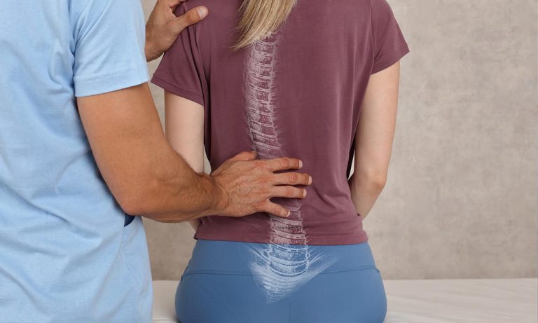 aiuto osteopatia scoliosi